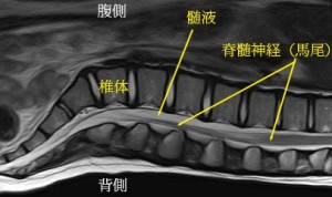 脊椎の基本17