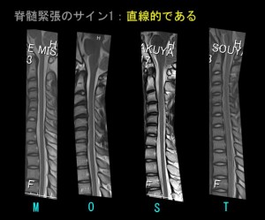 背骨17