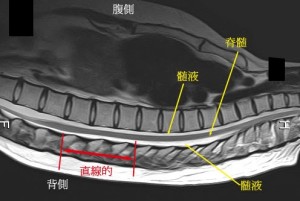 脊椎の基本18