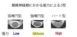 脊椎の基本23