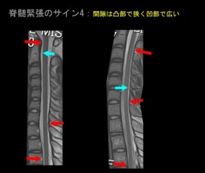 奇異運動と断面積06