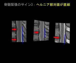 奇異運動と断面積05