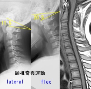 奇異運動と断面積08