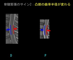 奇異運動と断面積04