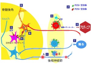 神経痛02