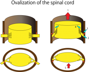 kch10