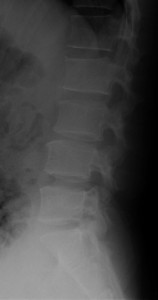 StandLumbar03